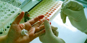 hepatita-c-testare