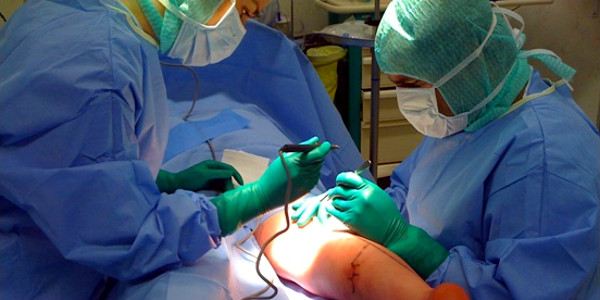 chirurgie-endovasculara
