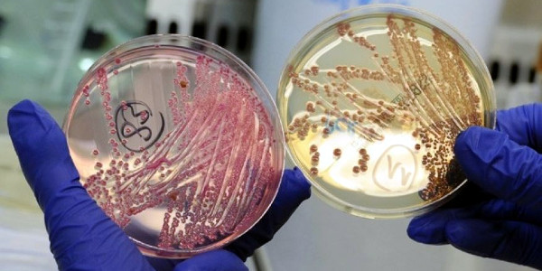 bacteria-e-coli
