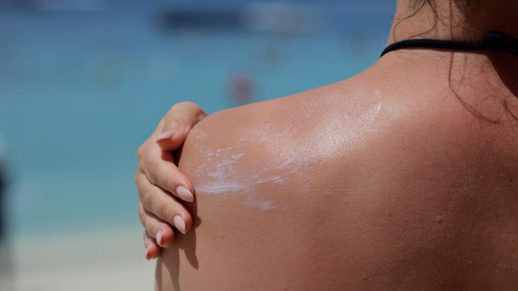 Tratamente naturiste pentru pielea arsă de soare