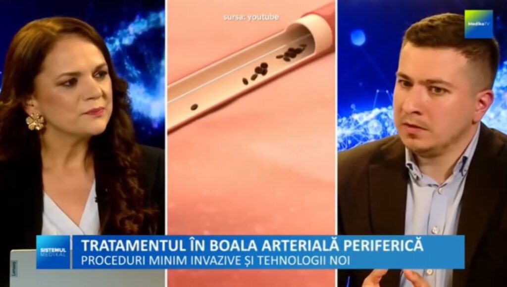 Soluții terapeutice pentru pacienții cu alergie la substanța de contrast VIDEO