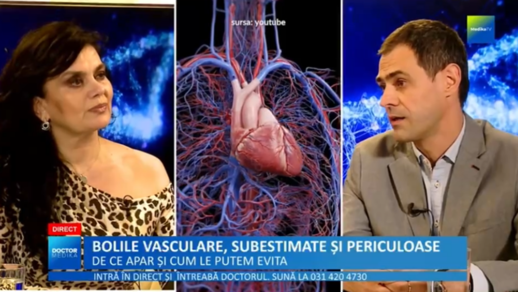 Ce este boala obstructivă cerebro-vasculară și cum ne afectează sănătatea VIDEO